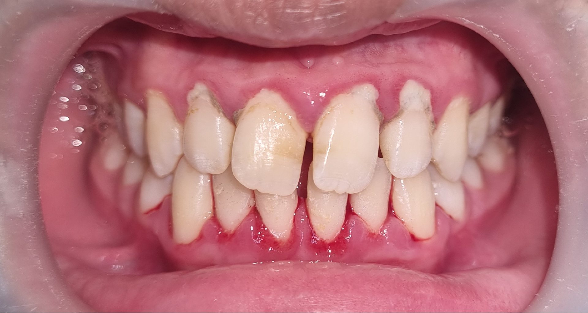 scaling-before