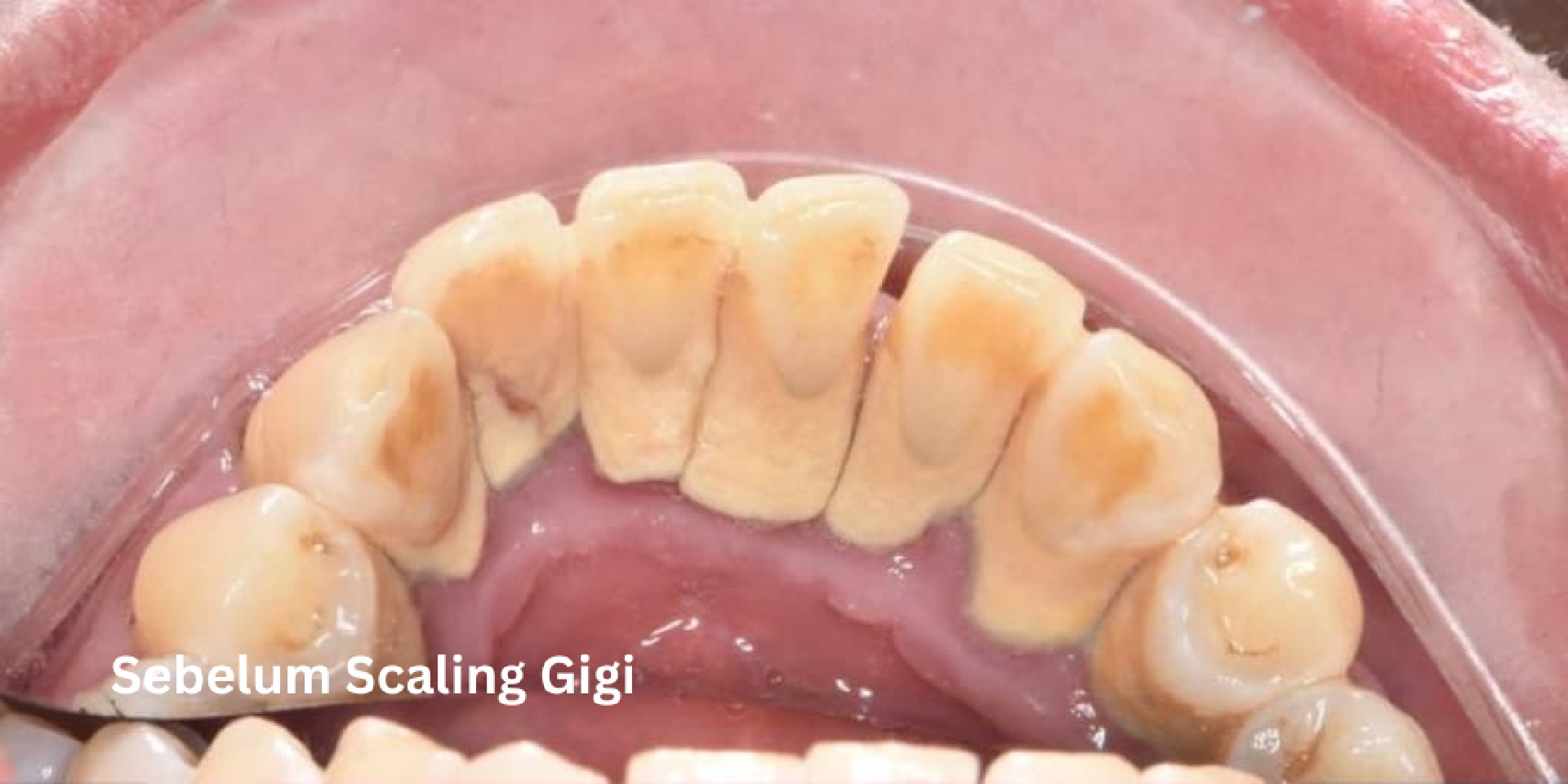 scaling-gigi-before-3